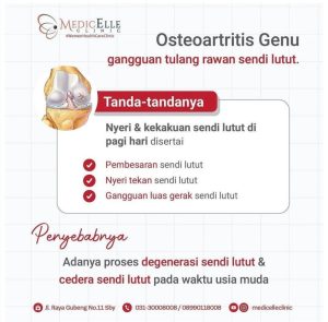 Kenapa Kelebihan Berat Badan Membebani Sendi Lutut